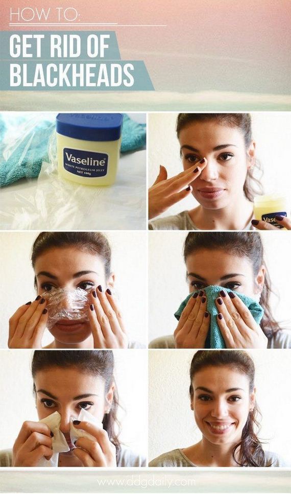 01-how-to-get-rid-of-blackheads