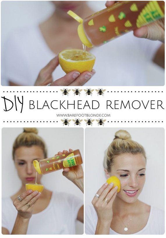 04-how-to-get-rid-of-blackheads